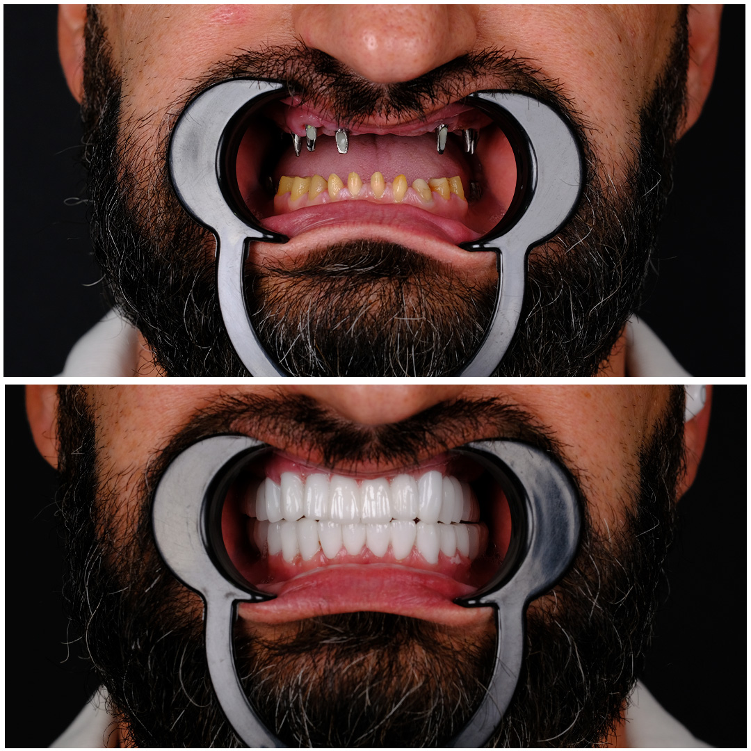 Prosthodontist (dental implant)